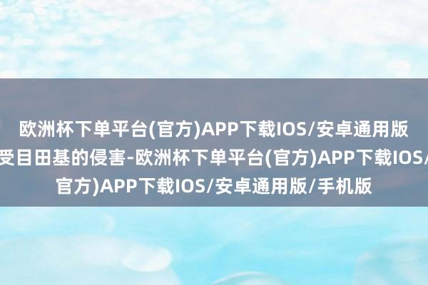 欧洲杯下单平台(官方)APP下载IOS/安卓通用版/手机版保护细胞免受目田基的侵害-欧洲杯下单平台(官方)APP下载IOS/安卓通用版/手机版